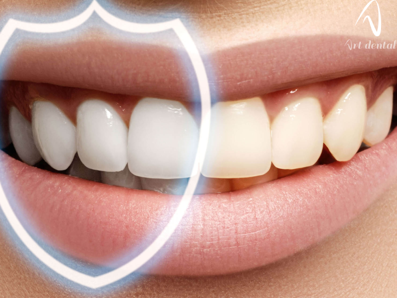 کامپوزیت خوب چه ویژگی‌هایی دارد؟