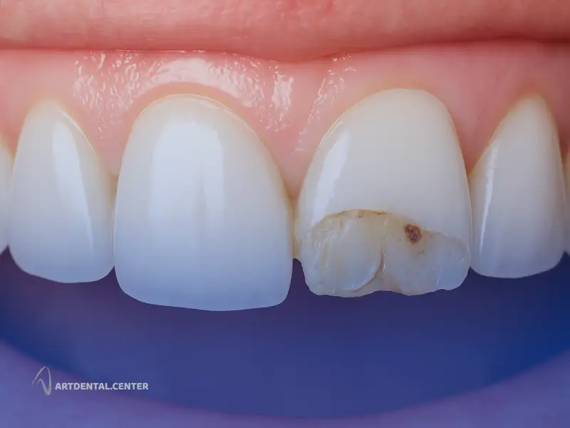 مراجعه منظم به دندانپزشک