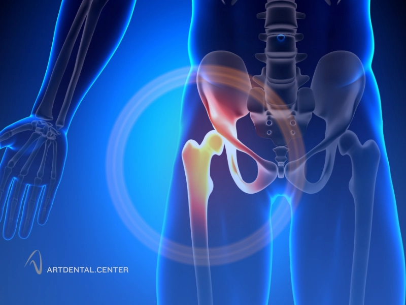 مراحل انجام پیوند استخوان کف لگن برای فک
