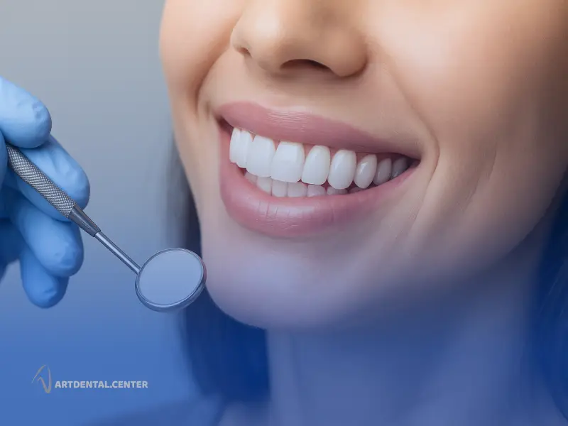 مراقبت از لمینت دندان؛ راهنمای کامل برای ماندگاری لبخند شما